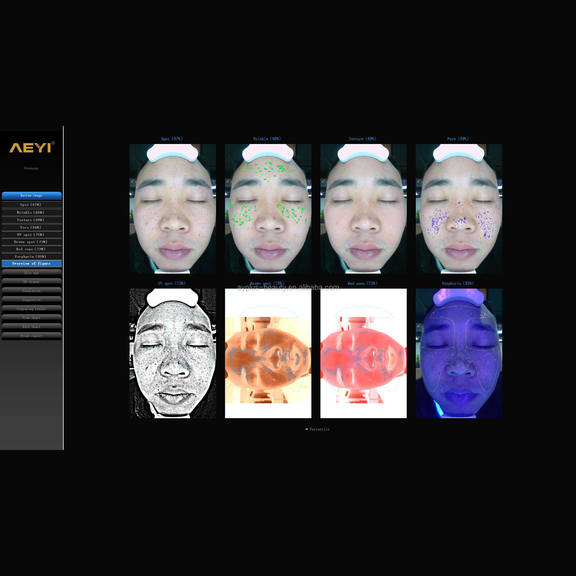 Digital Skin Analyser - Image 5