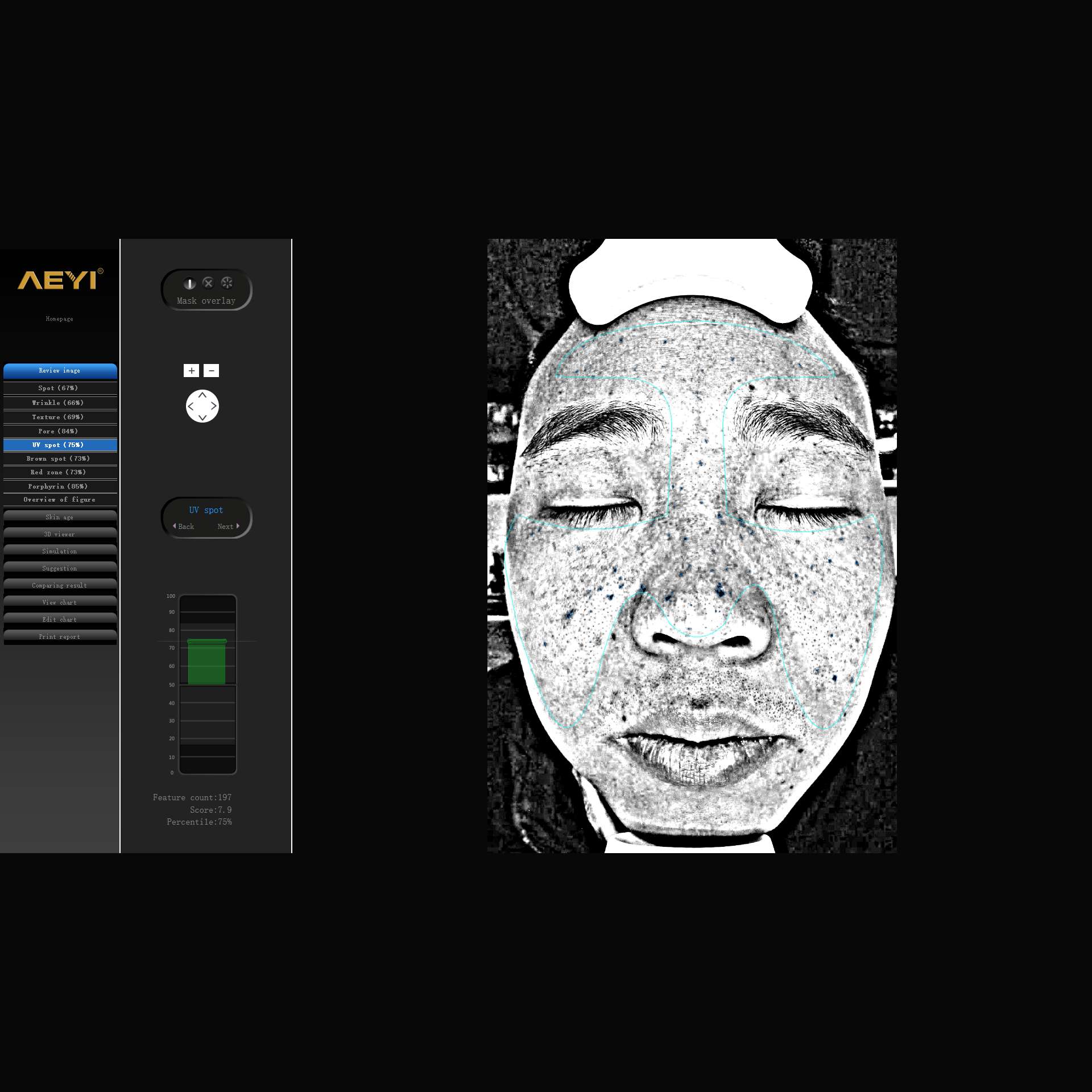 Digital Skin Analyser - Image 3